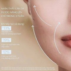 Kem dưỡng Estee Lauder Supreme+Youth Power Soft Creme phục hồi da chuyên sâu, 50ml