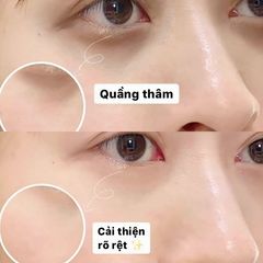 Kem dưỡng mắt Estee Lauder Advanced Night Repair Eye Gel-Creme Multi - 5ml (New)