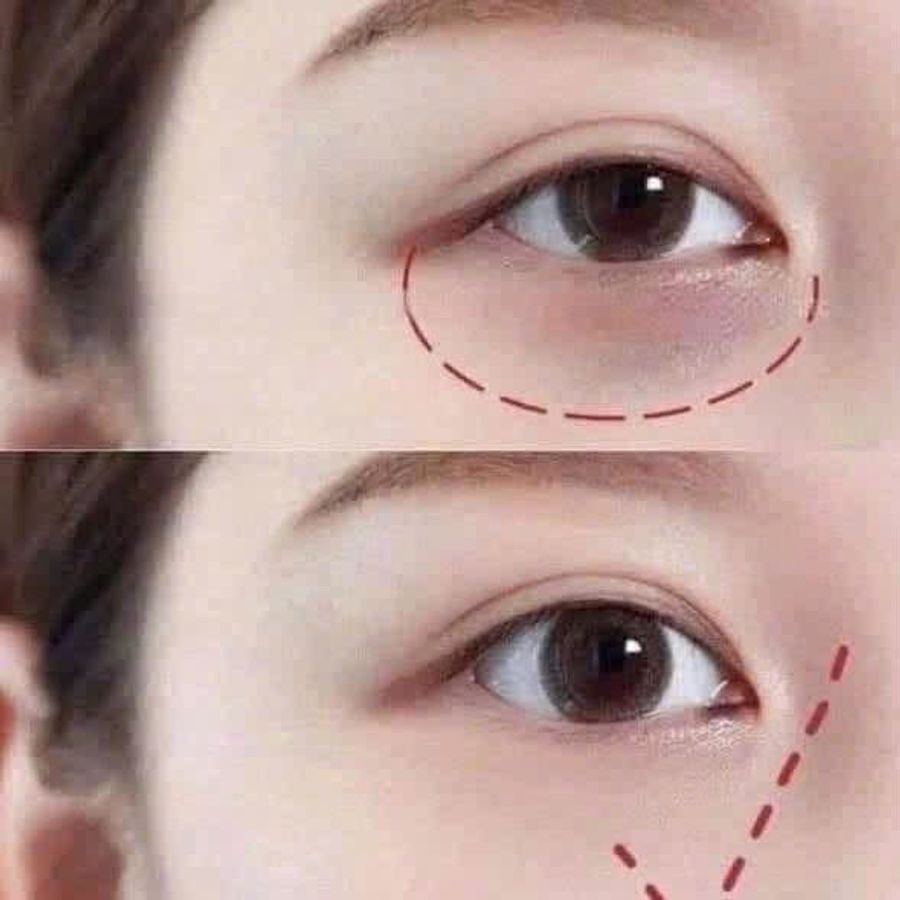 Kem dưỡng mắt SkinPower Eye + Line Filler Cream trẻ hóa và giảm nhăn chuyên sâu - 2.5g (New)