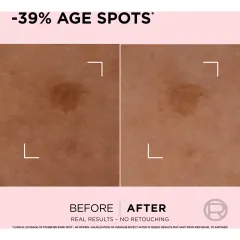 Serum L'oreal Age Spot Rapid Corrector trắng đều màu da và giảm đốm nâu, 30ml