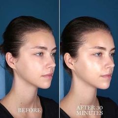 Mặt nạ Lancome Advanced Genifique Hydrogel Melting trẻ hoá và phục hồi da cao cấp (THANH LÝ)
