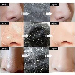 Gel Daiso Pore Cleansing loại bỏ mụn đầu đen, làm sạch và se khít lỗ chân lông 20g