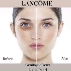 Combo 4 tinh chất Lancome Genifique Yeux Light-Pearl đầu bi massage trẻ hóa vùng mắt, 5mlx4