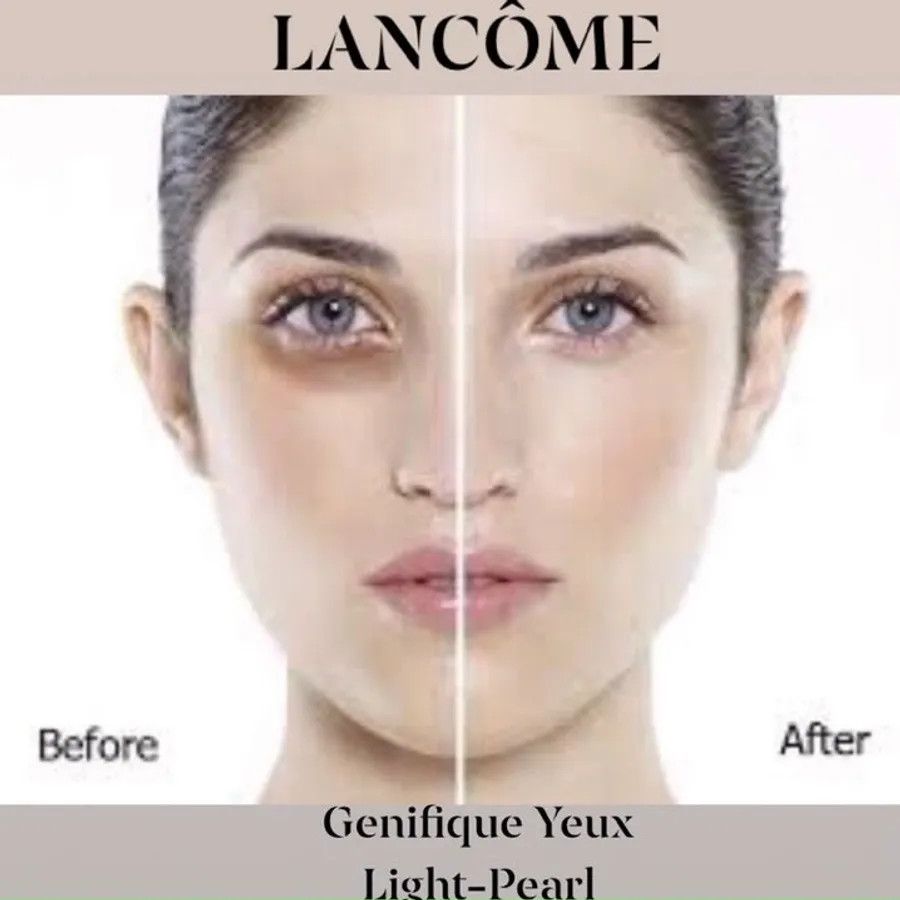 Combo 4 tinh chất Lancome Genifique Yeux Light-Pearl đầu bi massage trẻ hóa vùng mắt, 5mlx4