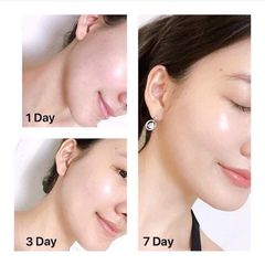 Tinh chất Lancome Genifique Ultimate phục hồi tối ưu, trẻ hóa da, 7ml (New)