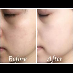 Combo 5 serum Estee Lauder ANR Synchronized II phục hồi, khỏe da - Kèm son Estee #420 hồng đỏ 