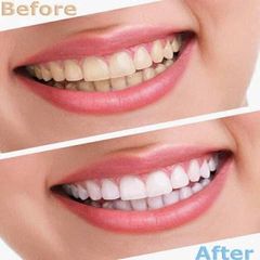 Kem đánh răng Crest 3D White trắng răng và chăm sóc răng miệng số 1 tại Mỹ