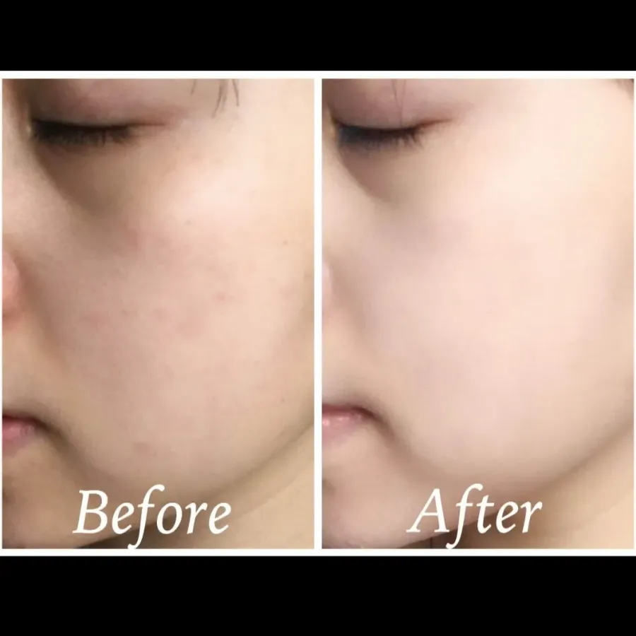 Combo Estee Lauder chống lão hóa, phục hồi chuyên sâu và sáng căng mịn da (HOT)