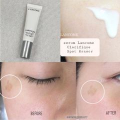 Serum Lancome Clarifique Spot Eraser trị sạm nám, đều màu và trắng sáng da, 10ml (new)