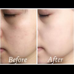 Combo 5 serum Estee Lauder Advanced Night Repair Synchronized II phục hồi, trẻ hóa, nuôi dưỡng làn da. 