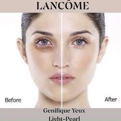 Tinh chất Lancome Genifique Yeux đầu bi massage trẻ hóa vùng mắt, 5ml.