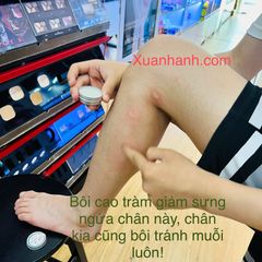Cao tinh dầu tràm Befine giữ ấm cơ thể, chống cảm cúm, côn trùng, xua muỗi giảm dị ứng.