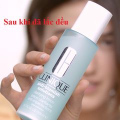 Nước hoa hồng Clinique Anti-Blemish Clarifying Lotion cân bằng độ ẩm cho da dầu mụn.